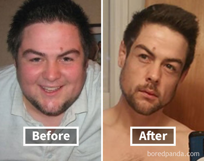 Before and after photos showing face fat loss and weight reduction transformation.