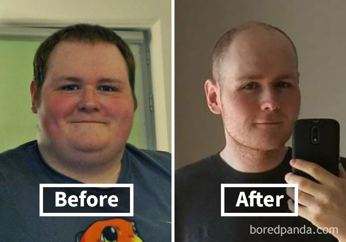 Face fat loss transformation shown in before and after weight loss photos.