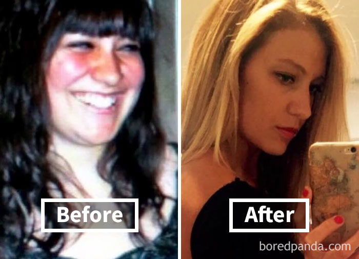 Before and after face fat loss photo comparison.