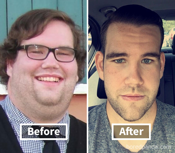Before and after photo showing face fat loss.