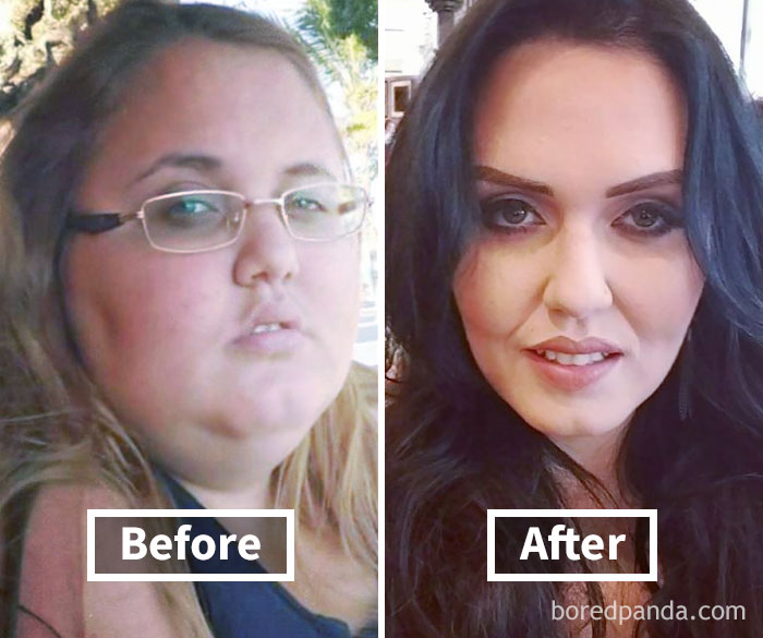 Before and after photos showing a woman's face fat loss transformation after weight loss.