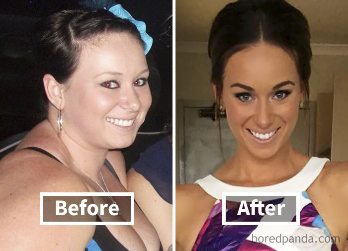 Before and after photos showing face fat loss transformation from weight loss journey.