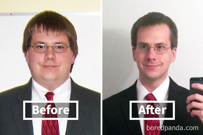 Before and after face fat loss transformation, showing weight loss effects.