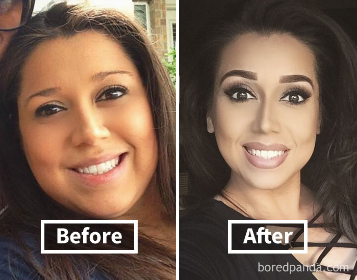 Face fat loss before and after weight loss transformation of a woman smiling.