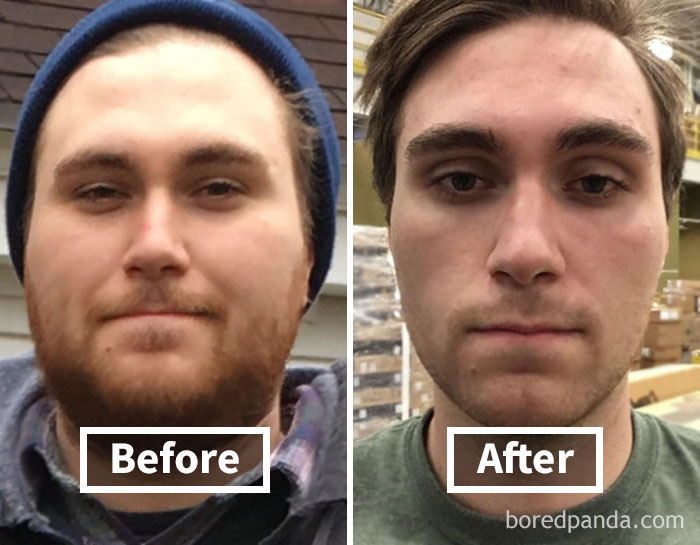 Before and after face fat loss transformation, showing noticeable weight loss changes in the face.