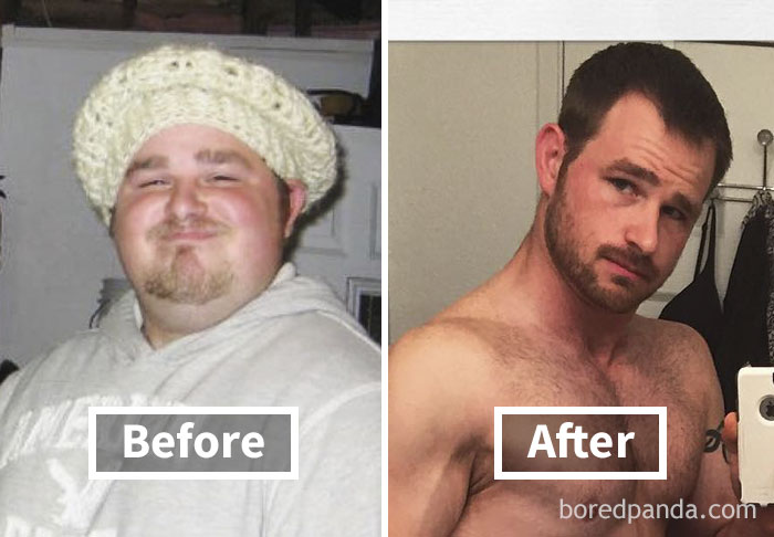 Face fat loss transformation with before and after weight loss photos.