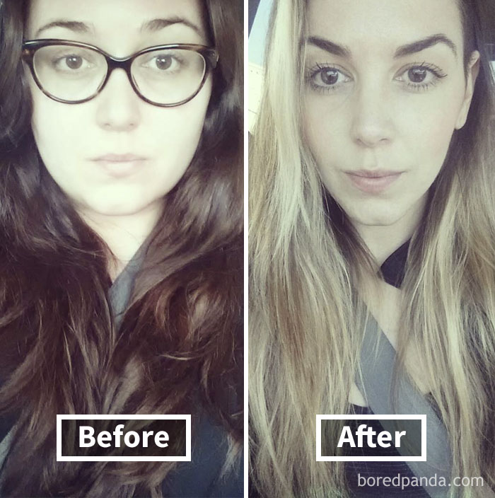 Before and after weight loss showing face fat loss transformation.