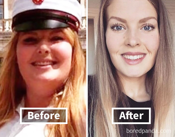 Before and after face fat loss photos showing significant weight loss transformation.