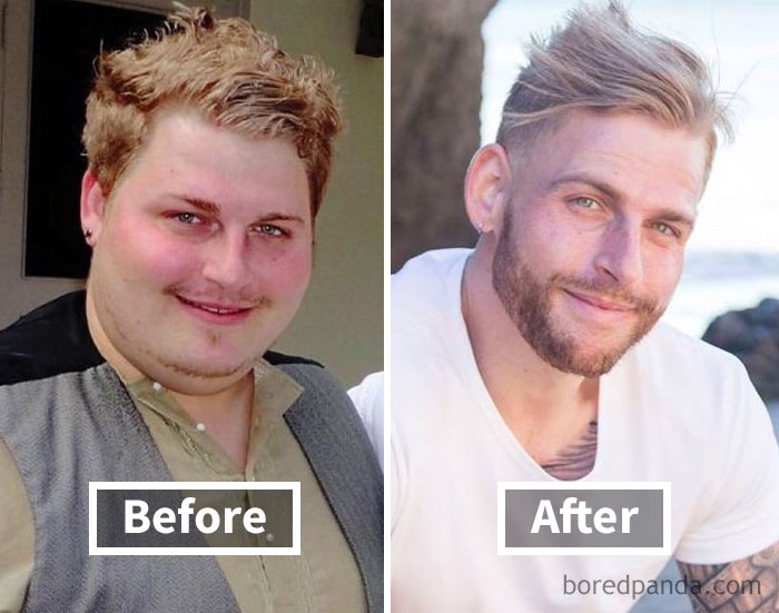 Before and after weight loss face transformation highlighting face fat loss in two side-by-side photos.