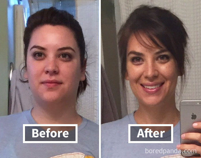 Before and after comparison of face fat loss showcasing weight loss transformation.