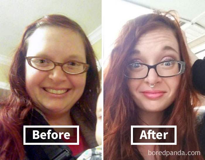 Before and after face fat loss; noticeable changes following weight loss.