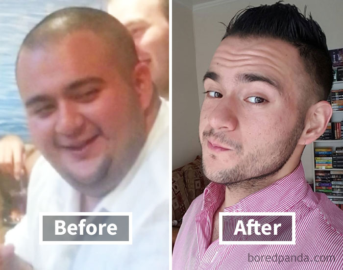 Before and after photos showing face fat loss transformation.
