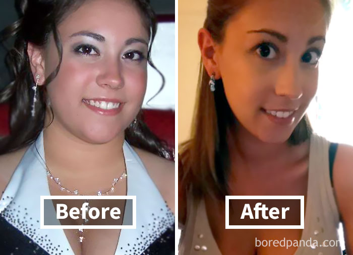 Before and after weight loss face transformation, highlighting face fat loss.