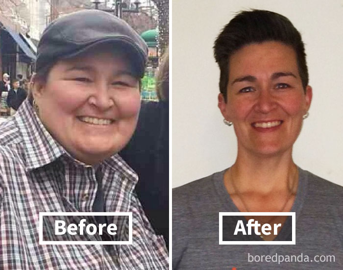 Before and after face fat loss highlighting transformation through weight loss.