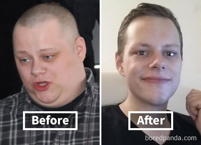 Face fat loss transformation shown in before and after weight loss photos.