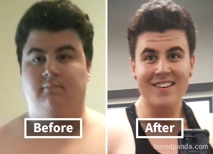 Face fat loss before and after weight loss, showing noticeable transformation in appearance.