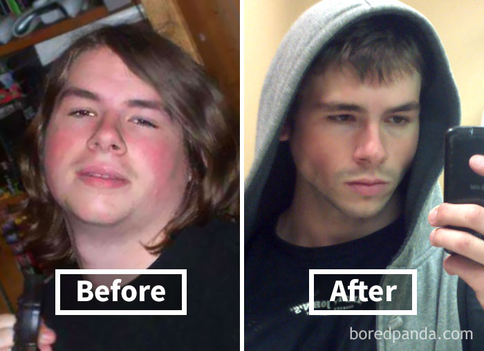 Before and after comparison of face fat loss results in young man, showing noticeable weight loss transformation.