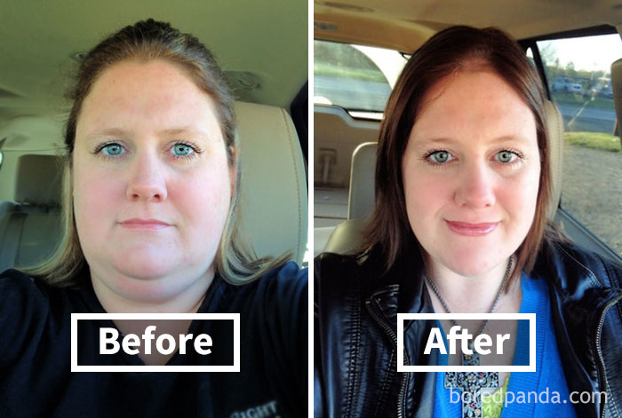 Before and after face fat loss showing noticeable weight loss in a woman's facial features.