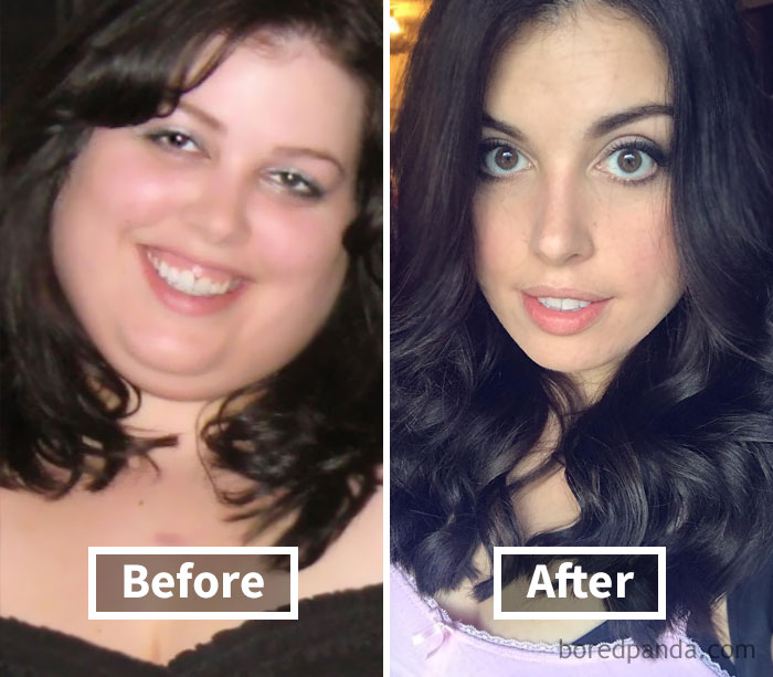 Before and after weight loss showing face fat loss transformation.