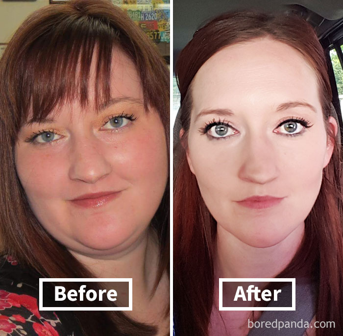 Before and after face fat loss comparison showing significant changes in facial features.