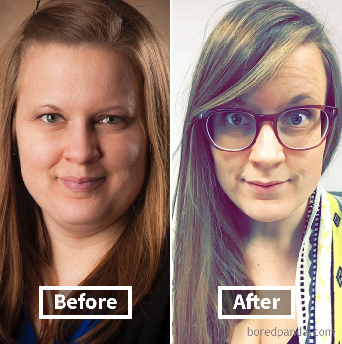 Before and after weight loss showing face fat reduction in a side-by-side comparison.