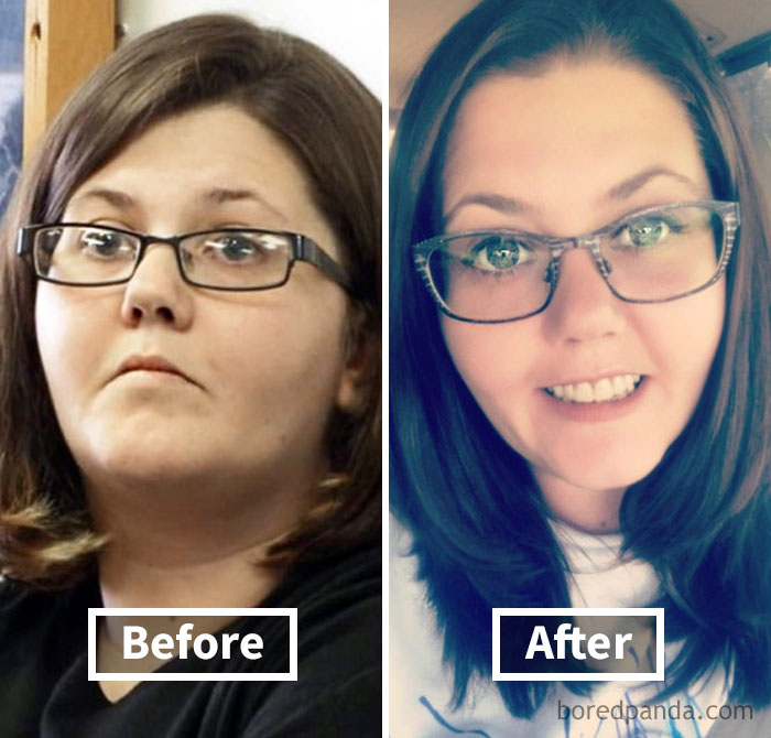 Before and after face fat loss transformation, showing noticeable weight loss and facial slimming.