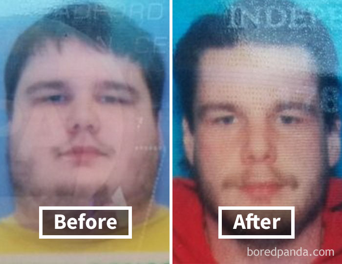 Before and after weight loss showing face fat reduction.