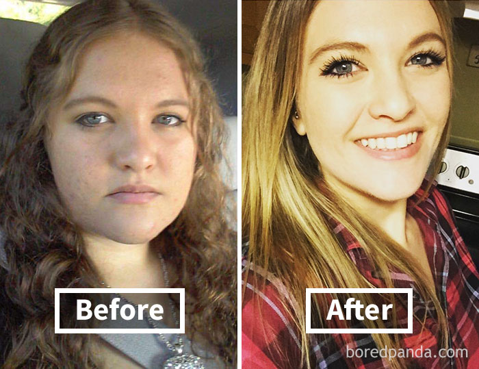 Before and after photo of face fat loss showing transformation in weight loss.