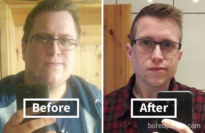Before and after face fat loss photos showing significant weight loss transformation.