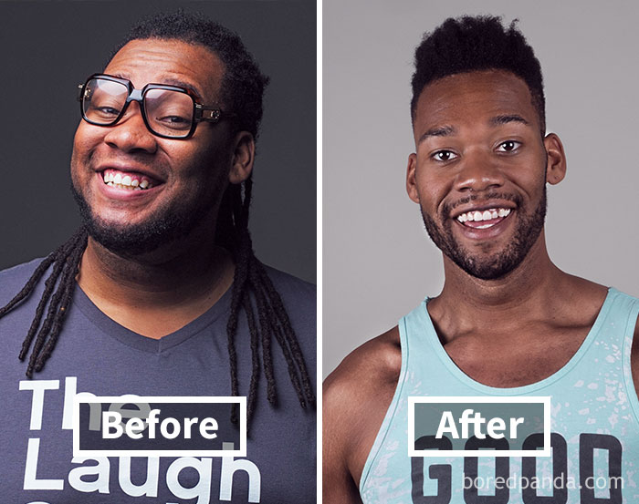 Before and after face fat loss showing significant transformation in weight loss journey.