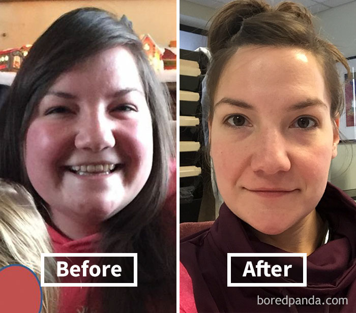 Before and after face fat loss transformation showing significant weight loss in a woman's face.