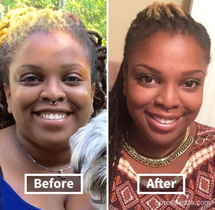 Face fat loss before and after weight loss comparison, showcasing visible transformation.