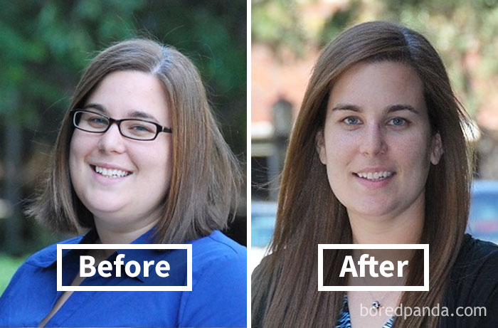 Before and after face fat loss comparison of a woman, showing significant weight loss.