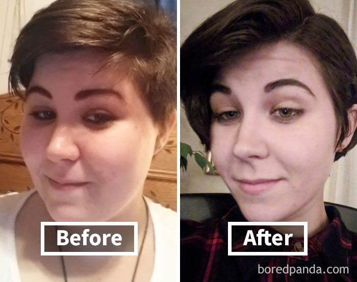 Before and after comparison showing face fat loss results from weight loss.