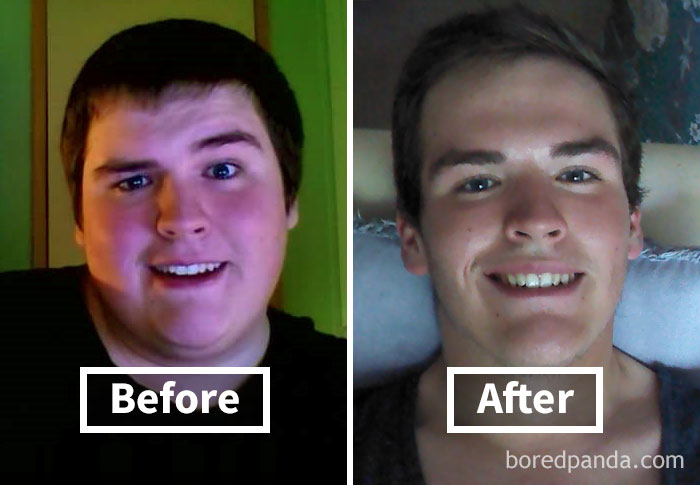 Face fat loss shown in before and after weight loss photos, featuring noticeable changes in facial structure.