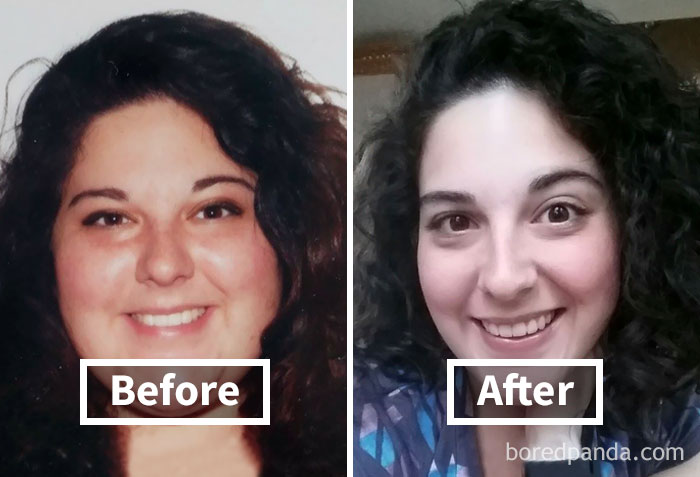 Before and after photos showing face fat loss transformation and weight loss impact.