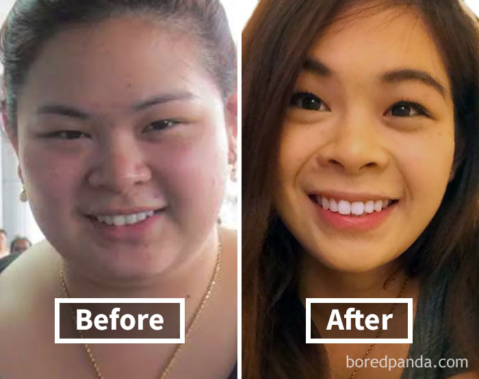 Before-and-after images showing face fat loss with weight loss transformation.