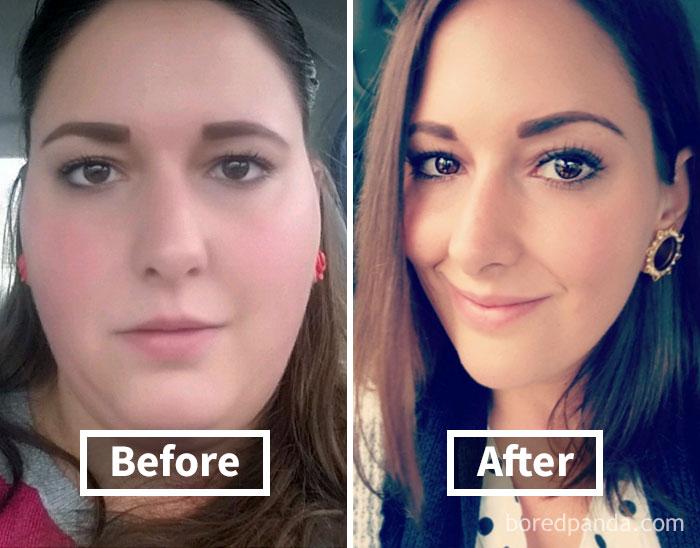 Before and after images show significant face fat loss following weight loss.