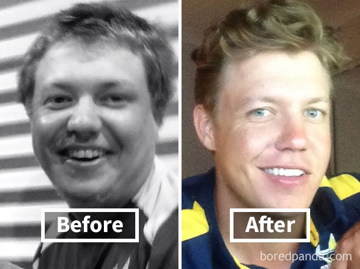 Before and after comparison of face fat loss, showing significant transformation.