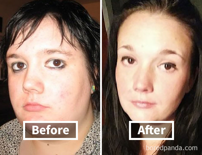 Before and after photos showing face fat loss results.