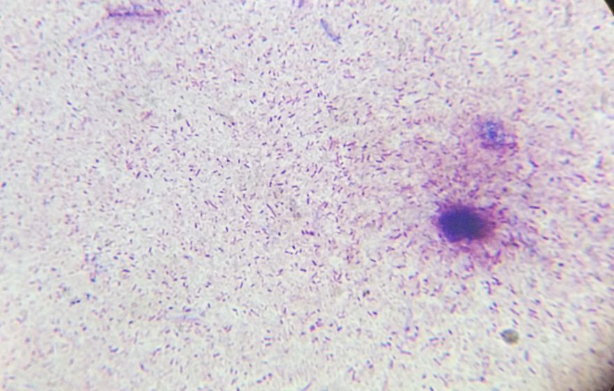 I Find Cosmos Under My Microscope And With Microbial Plate - Microsmos