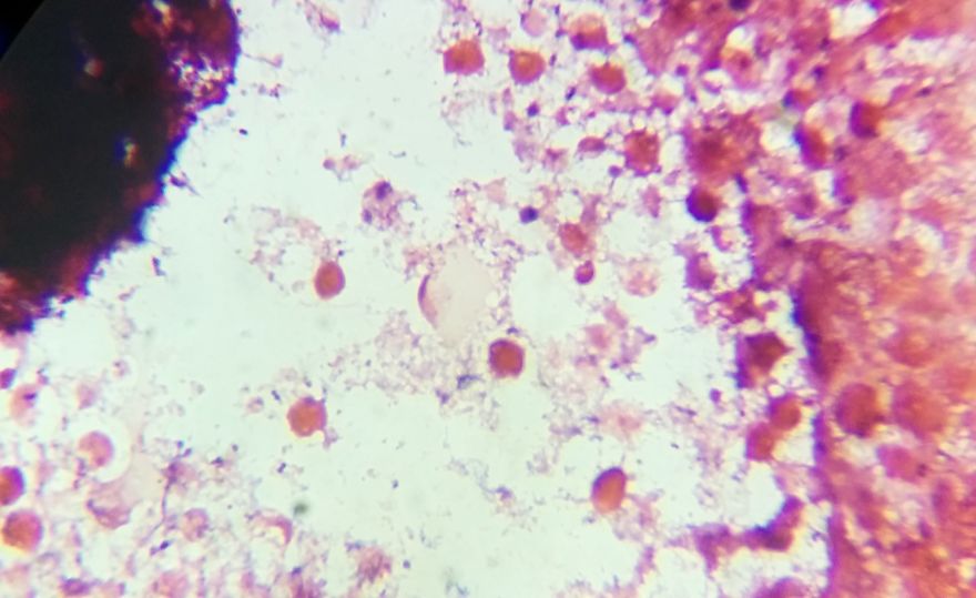 I Find Cosmos Under My Microscope And With Microbial Plate - Microsmos I Find Cosmos Under My Microscope And With Microbial Plate - Microsmos