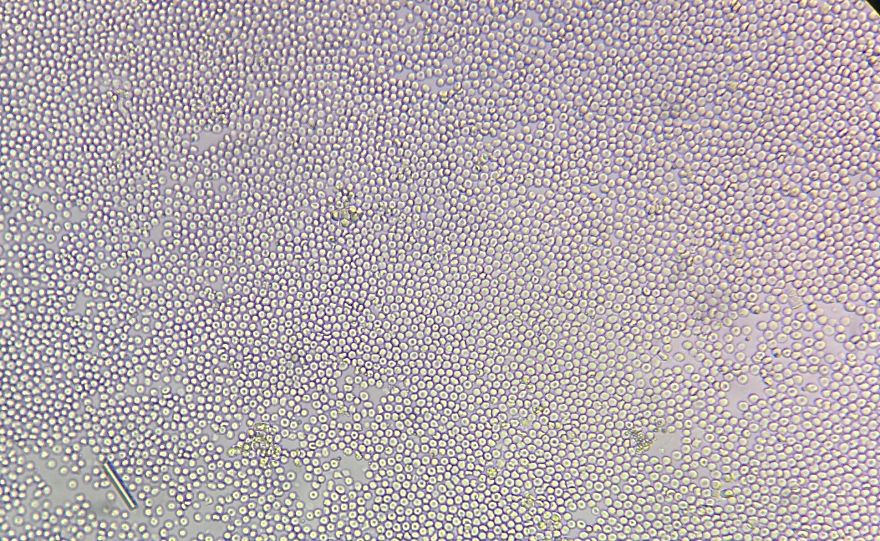 I Find Cosmos Under My Microscope And With Microbial Plate - Microsmos