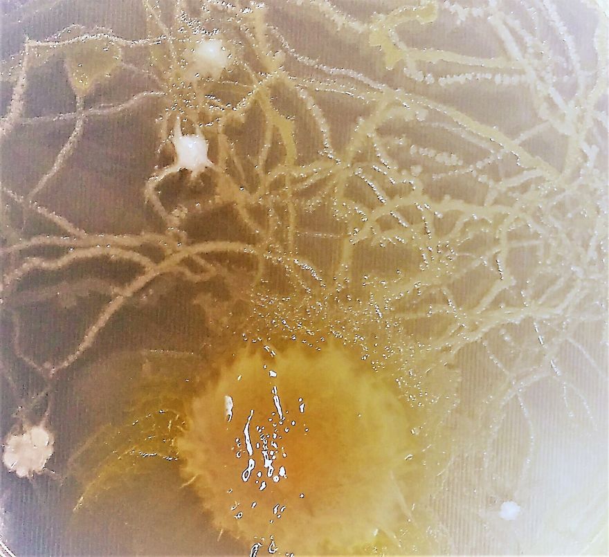 I Find Cosmos Under My Microscope And With Microbial Plate - Microsmos I Find Cosmos Under My Microscope And With Microbial Plate - Microsmos