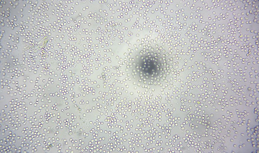 I Find Cosmos Under My Microscope And With Microbial Plate - Microsmos