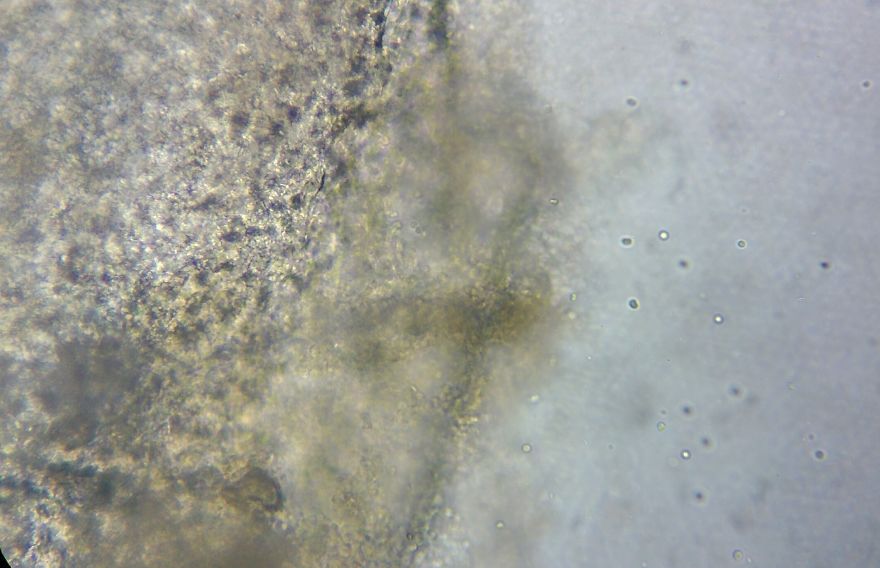 I Find Cosmos Under My Microscope And With Microbial Plate - Microsmos