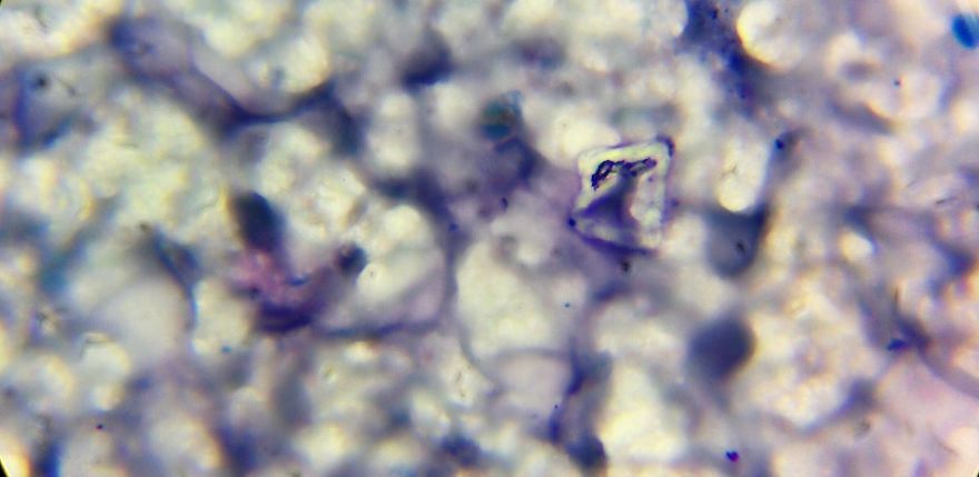 I Find Cosmos Under My Microscope And With Microbial Plate - Microsmos