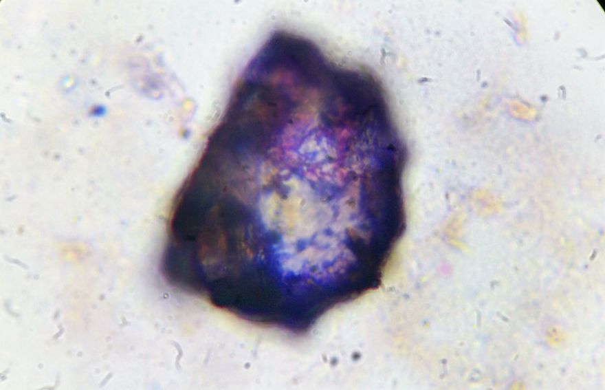 I Find Cosmos Under My Microscope And With Microbial Plate - Microsmos I Find Cosmos Under My Microscope And With Microbial Plate - Microsmos