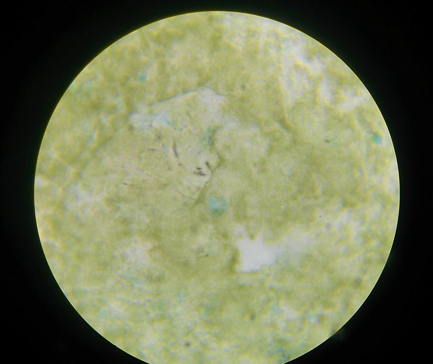 I Find Cosmos Under My Microscope And With Microbial Plate - Microsmos