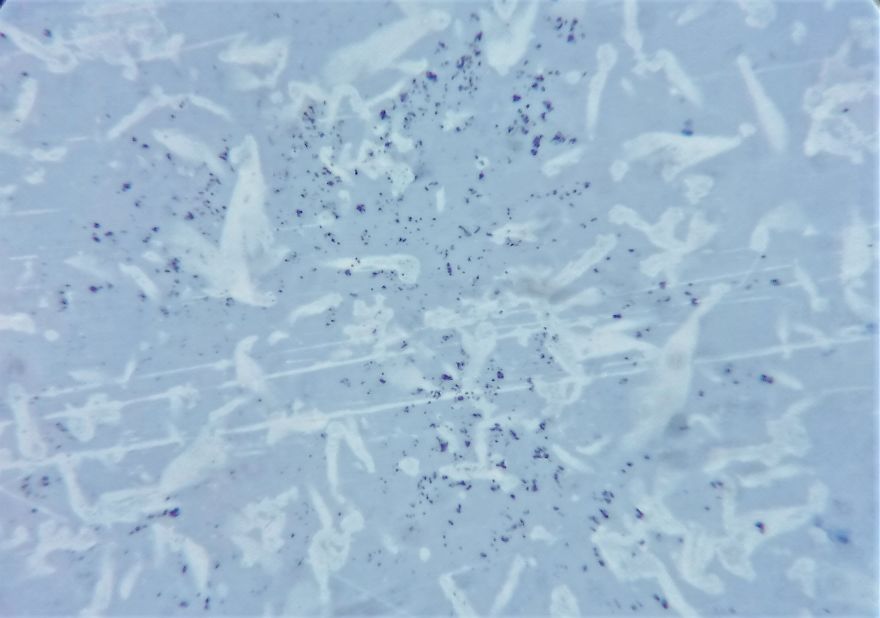 I Find Cosmos Under My Microscope And With Microbial Plate - Microsmos I Find Cosmos Under My Microscope And With Microbial Plate - Microsmos
